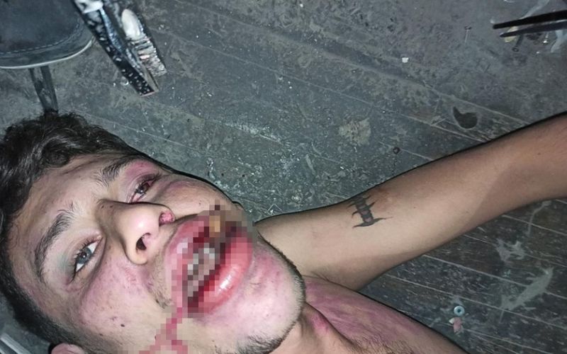 Hamam böceği yedirilen gencin dosyasında karar: Yağmadan beraat, hürriyeti tehditten 6 yıl 12 ay ceza
