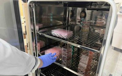 Parkinson’da bağırsak- beyin iletişimi çip üstü organ teknolojisiyle araştırılıyor
