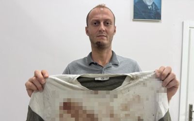 Gürültü tartışması sopalı kavgayla bitti: O anlar kamerada
